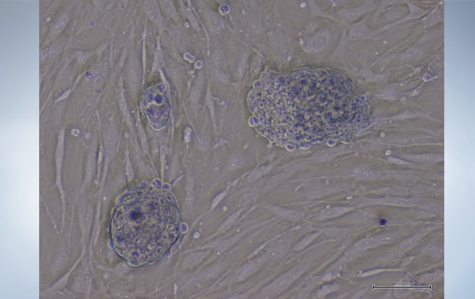 奥林巴斯倒置显微镜